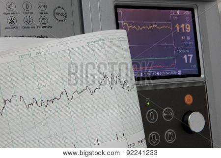 Displaying results of cardiography of fetal heart rate