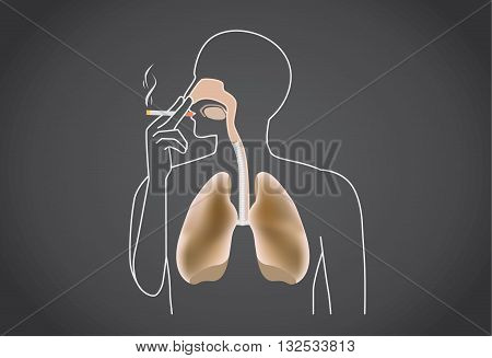 Smoker's lung is black from tar. This illustration about medical.