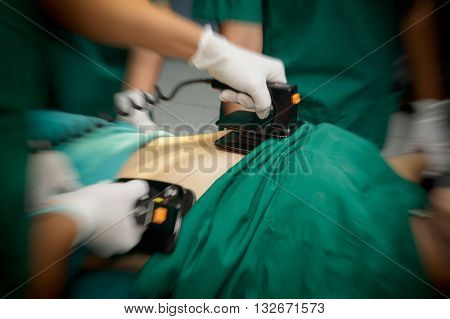 Defibrillator practice on a CPR with motion blur