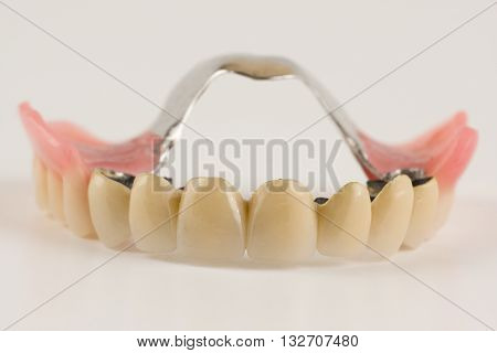 Clasp Prosthesis With And Latch Ceramic Crowns