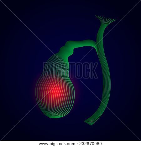 Illustration Of Human Gallbladder With Pain Center. 3d Human Organ.