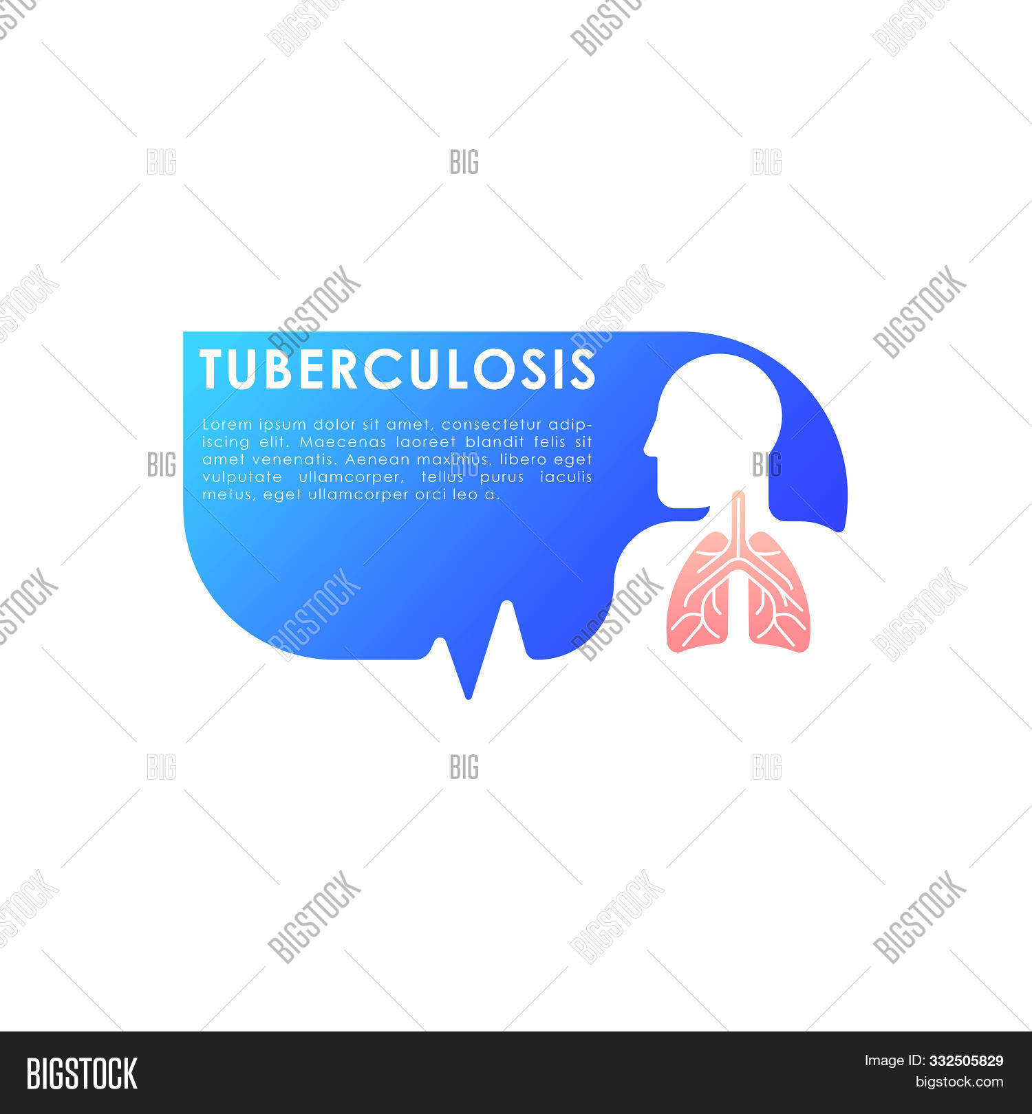 Tuberculosis. Vektörü (Ücretsiz Deneme) | Bigstock