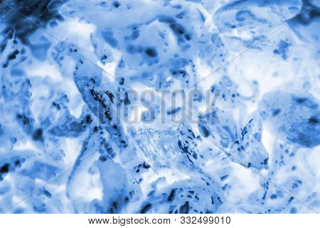 Cancer Cells Under The Microscope. Tissues Affected By Cancer Cells Under A Microscope, Science. Can