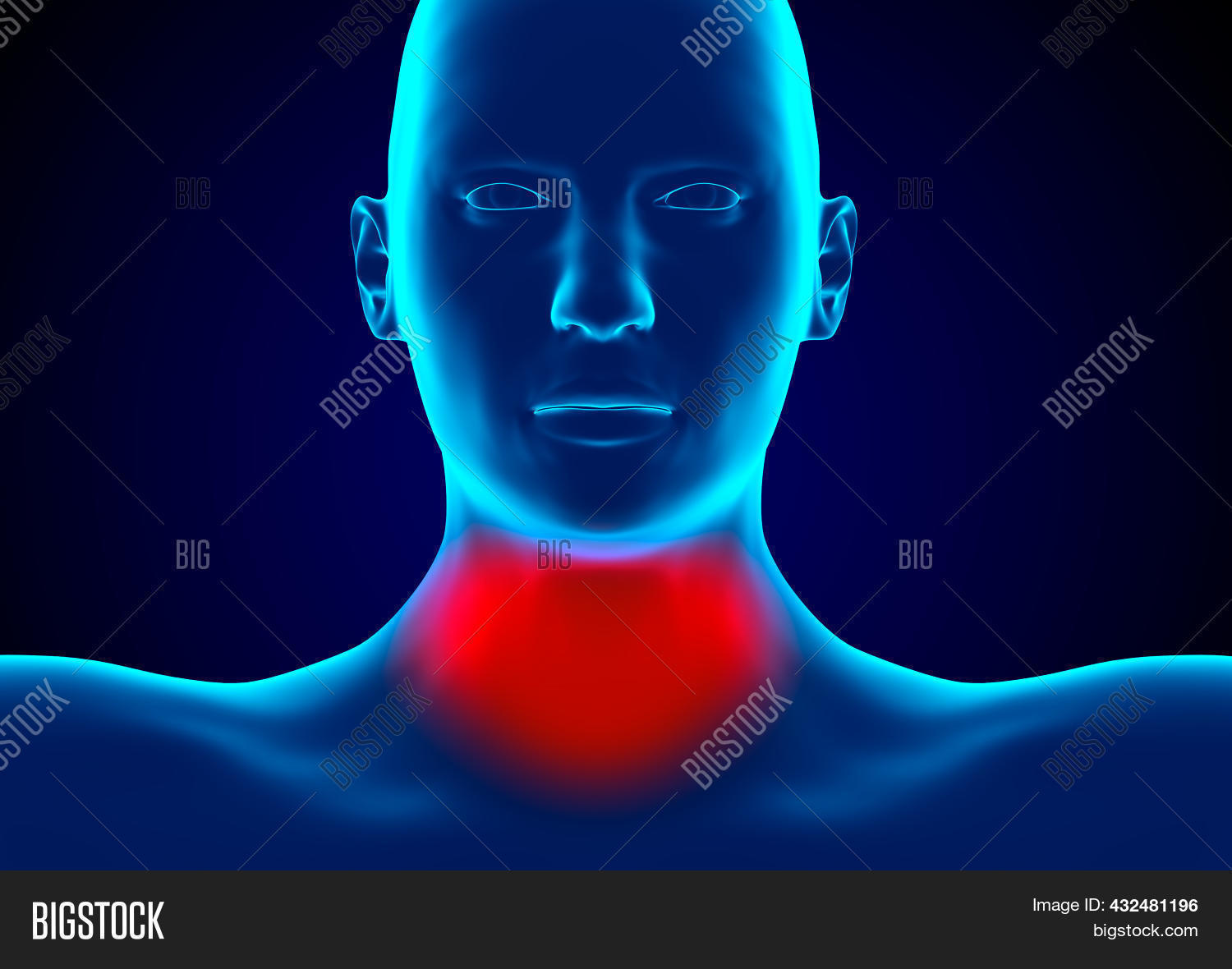 Pharyngitis Infection Image & Photo (Free Trial) | Bigstock