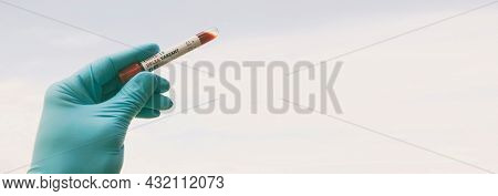The nurce holding  tube of blood test with the label Covid-19 DELTA Variant.