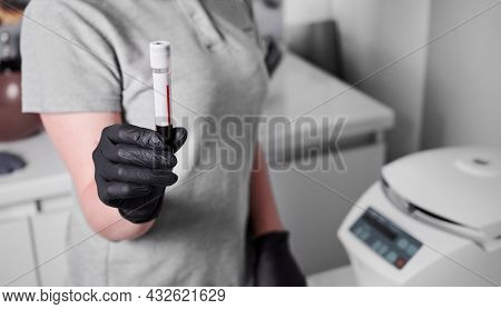 Plasmolifting Process. Preparation Of Blood For Injections. Cosmetologist In Black Rubber Gloves And
