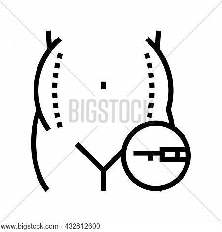 Liposuction Surgery Line Icon Vector. Liposuction Surgery Sign. Isolated Contour Symbol Black Illust