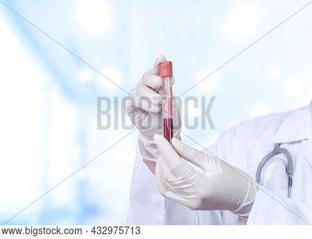Close Up Doctor\'s Hand In Medical Gloves Holding Test Tube (vacutainer) With Red Blood For Testing 
