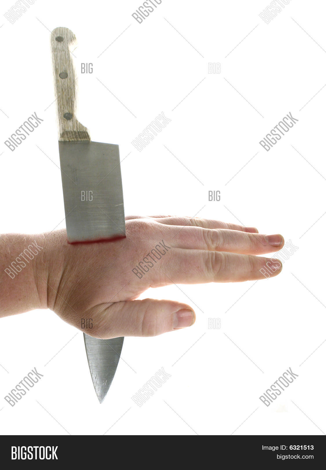 Knife Accident Image & Photo (Free Trial) Bigstock