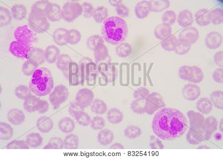 Neutrophil