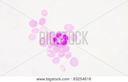 Neutrophils Are A Type Of Phagocyte And Are Normally Found In The Bloodstream.