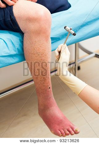Medical Examination At The Orthopedic