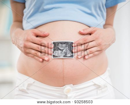 Pregnancy