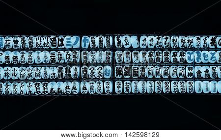 TOKYO, JAPAN - MAY 15: Lanters are lit at night on May 15, 2013 in Tokyo. Sensoji Temple, founded in 645 CE, making it the oldest temple in Tokyo.