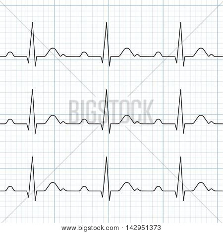 Vector cardiogram, flat design ,Heart Beat and Electrocardiogram