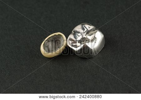 Cast And Cermet Dental Structures For Restoration Of Teeth