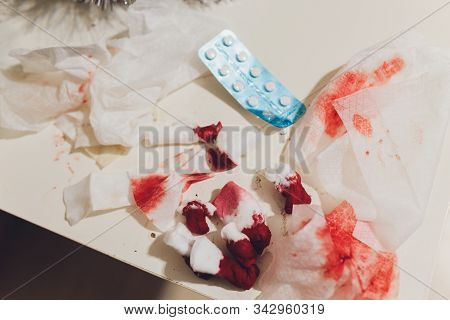 Garbage With Blood At Surgery. Image Wit Shallow Dof.
