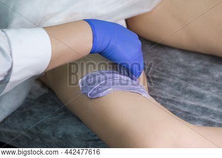 Beauty Concepts And Ideas. Closeup Of Beautician Hand During Depilation On Caucasian Female Legs Wit