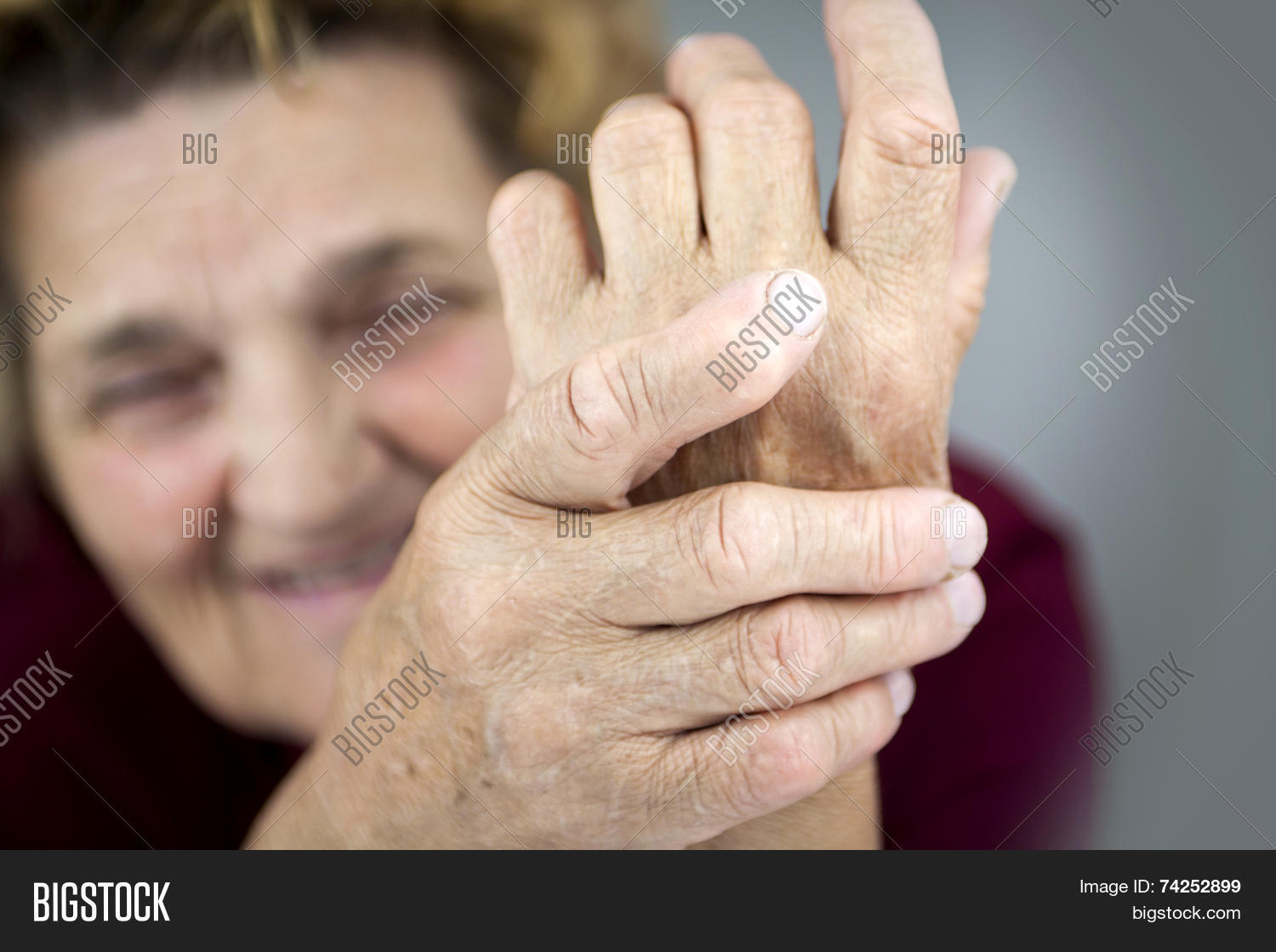 Hands Woman Deformed Image & Photo (Free Trial) Bigstock