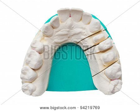Positive Teeth Cast