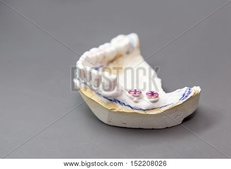 Technical shots of model on a dental prothetic laboratory