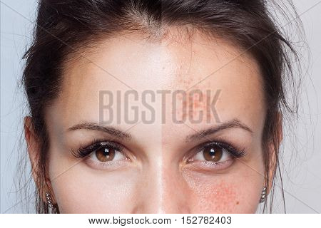 Before and after cosmetic operation. Young pretty woman portrait isolated on a white background. Before and after cosmetic or plastic procedure anti-age therapy