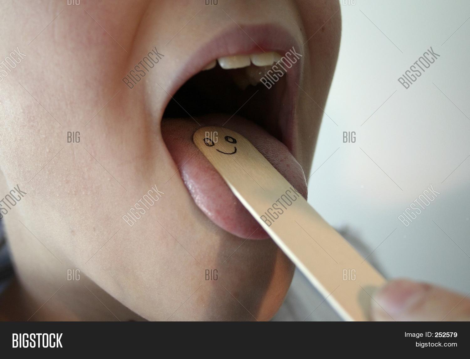 Image Preview