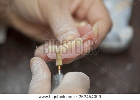Dental Technician Make Denture Prothesis In Dental Laboratory