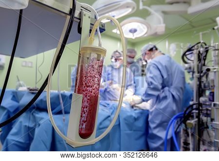 Ross's Operation Is The Surgical Treatment Of Aortic Valve Defects.