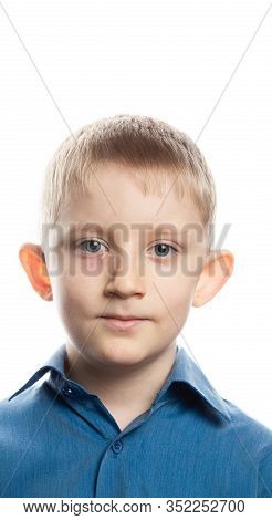 Herpes Is An Eye Disease On The Face Of A Child. Little Boy With Conjunctivitis. Rash Near The Eye. 