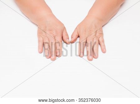 Dry Skin With Wrinkles On The Hands Of An Elderly Woman, White Background, Isolate. Fragility Of Blo