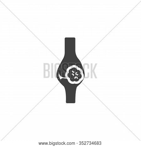 Osteogenic Sarcoma Vector Icon. Bone With Tumor Filled Flat Sign For Mobile Concept And Web Design. 