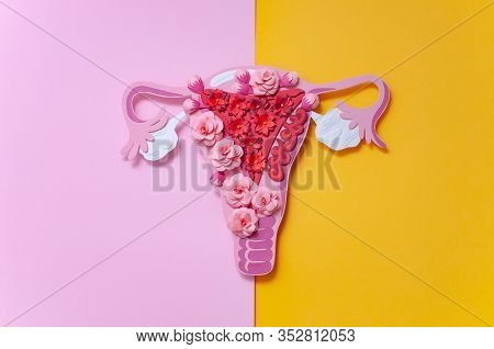 The Concept Of Endometriosis Of The Uterus. Diseases Of The Female Reproductive System. Health And D