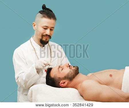 Acupuncture Treatment For Man Headache And Migraine. Certified Acupuncturist Treats A Mans Migraines