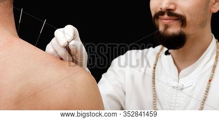 Needles For Acupuncture In A Mans Shoulder Close-up On A Black Background. A Reflexologist Very Accu