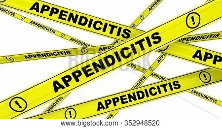 Appendicitis. Yellow Warning Tapes With Black Words Appendicitis (a Medical Condition In Which The A