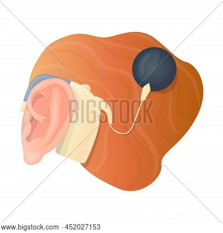 Vector Isolated Illustration With An Ear And A Hearing Aid, Where The Sound Processor Is Attached Wi