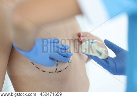 Plastic Surgeon Holds Silicone Chest Implant For Breast Augmentation. Plastic Surgery For Breast Cor