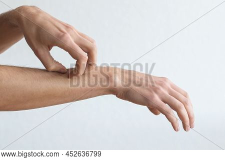 The Man Injured His Wrist. He Suffered A Tendon Injury, Arthritis In His Wrist, And De Quervain Dise