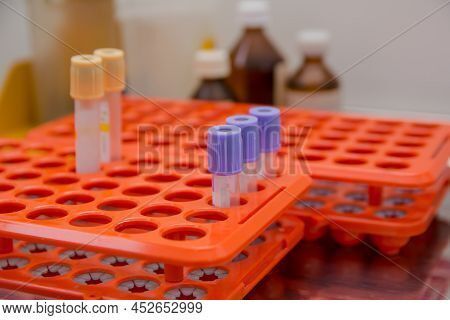 Laboratory Tray With Blood Collection Vacutainers  Mers-cov, Test,
