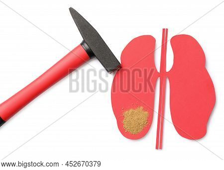 Paper Cutout With Sand And Hammer On White Background, Top View. Kidney Stone Disease
