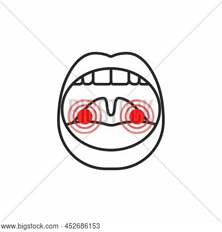Open Mouth Thin Line Icon Tonsillitis. Concept Of Face Part Symbol Or Bacterial Angina. Simple Linea