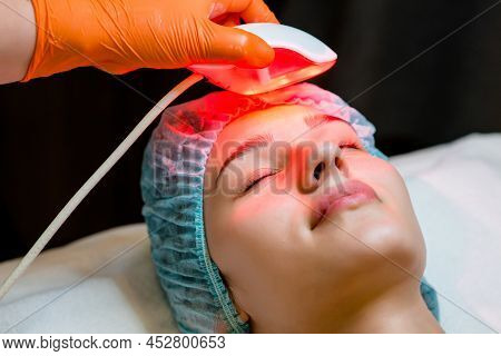 20-25 Years Old Woman Receiving A Non-surgical Rejuvenation Procedure, Rf Face Lifting With The Use 