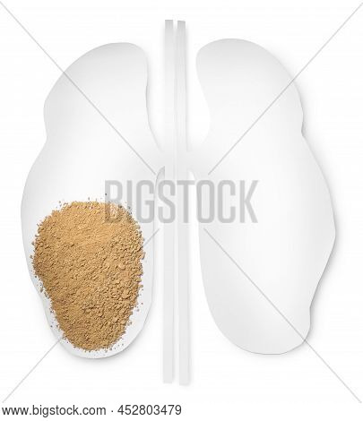 Paper Cutout With Sand On White Background, Top View. Kidney Stone Disease