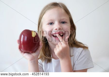 Smiling Girl Without Tooth Is Holding Apple. Pediatric Dentistry And Loss Of Milk Teeth Concept