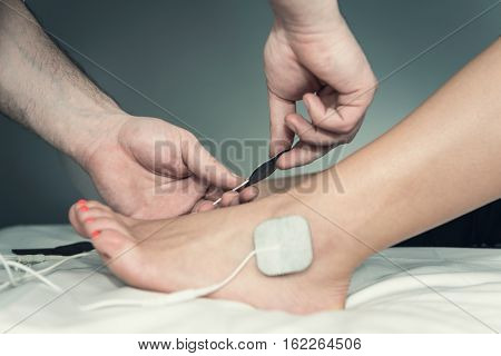Placing Tens Electrodes On Foot