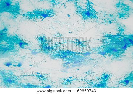 Cell Microscopic- Motor Neurous