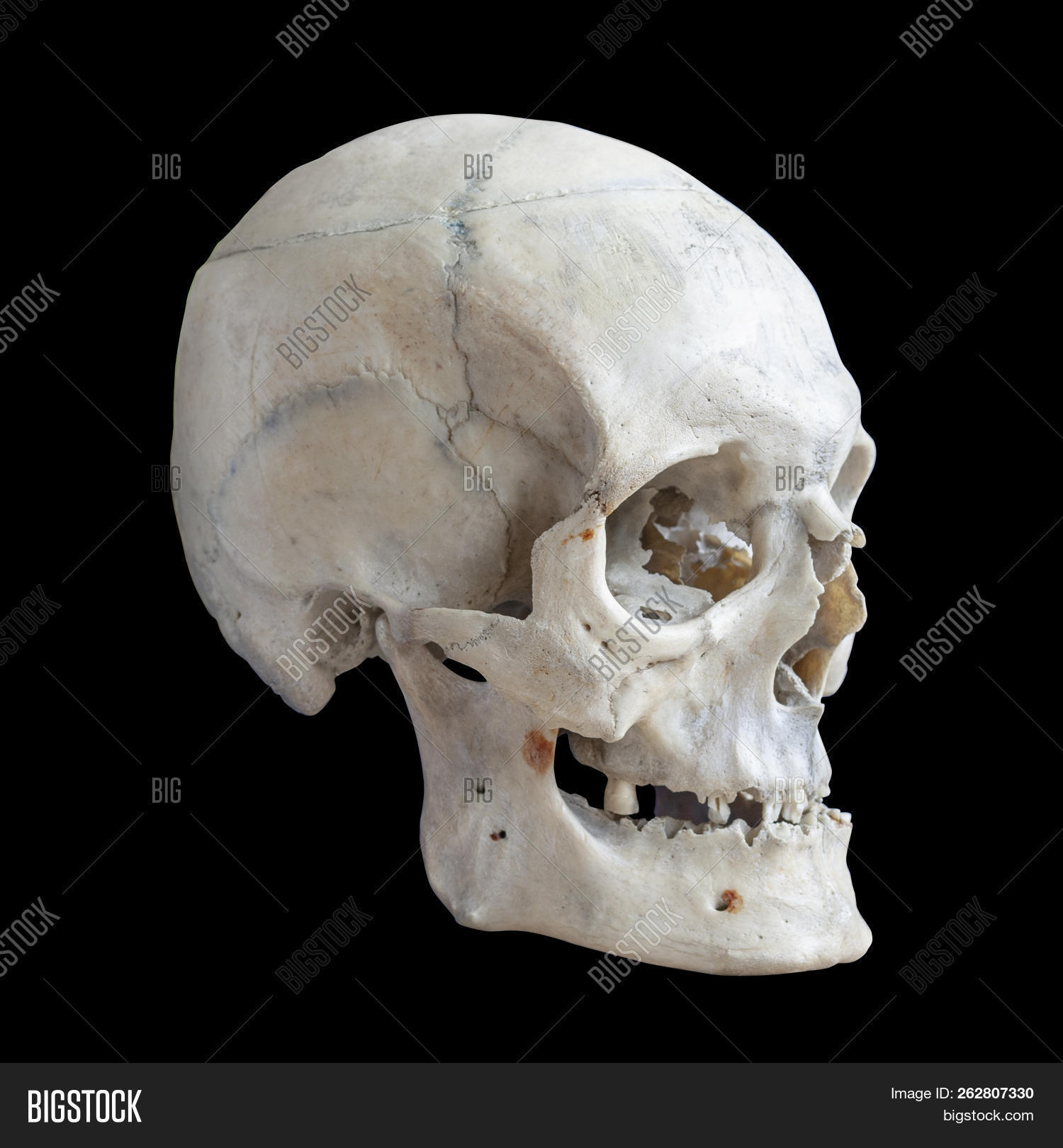 real human skull side view