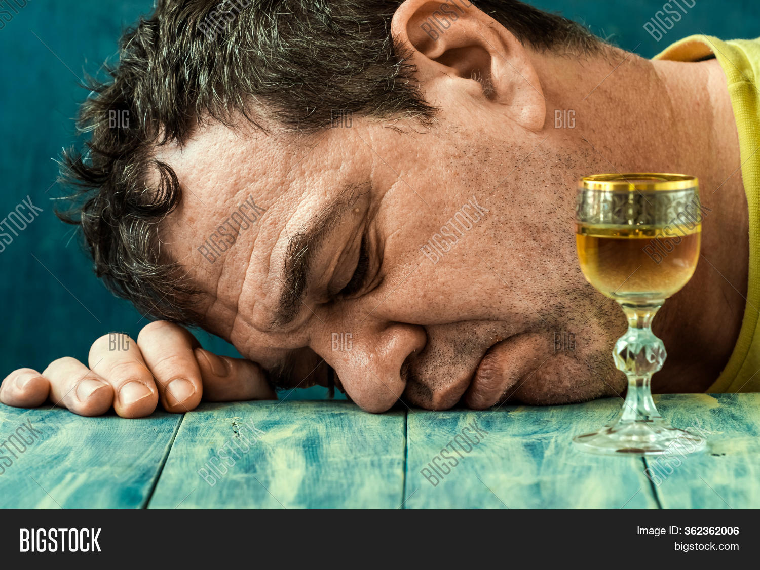 Severe Hangover. Man Image & Photo (Free Trial) Bigstock