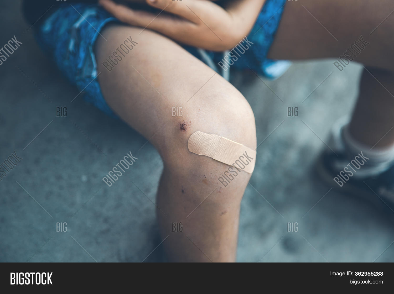 Boys Injured Leg Image & Photo (Free Trial) Bigstock